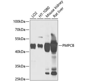 Western Blot - Anti-MPPB Antibody (A90403) - Antibodies.com
