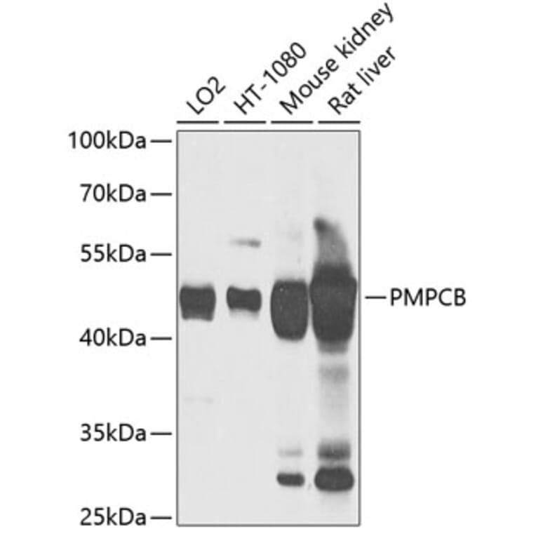 Western Blot - Anti-MPPB Antibody (A90403) - Antibodies.com
