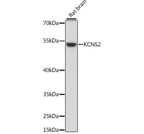 Western Blot - Anti-KCNS2 Antibody (A90405) - Antibodies.com