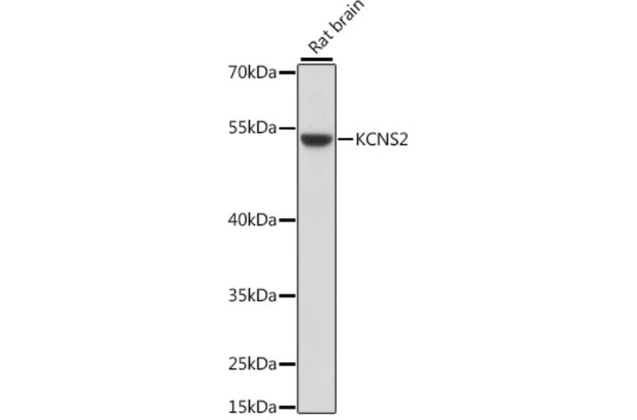 Western Blot - Anti-KCNS2 Antibody (A90405) - Antibodies.com