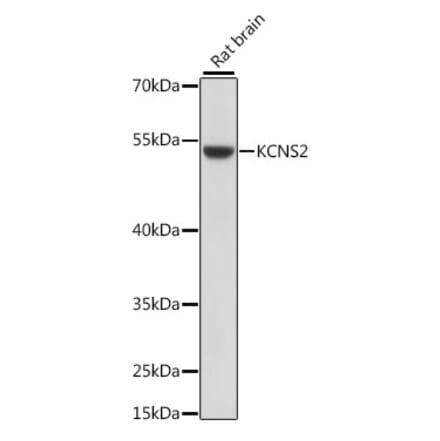 Western Blot - Anti-KCNS2 Antibody (A90405) - Antibodies.com