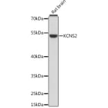 Western Blot - Anti-KCNS2 Antibody (A90405) - Antibodies.com