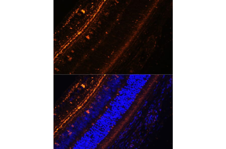 Immunofluorescence - Anti-KCNS2 Antibody (A90405) - Antibodies.com