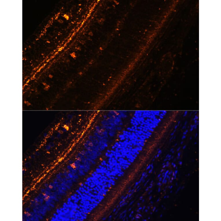 Immunofluorescence - Anti-KCNS2 Antibody (A90405) - Antibodies.com