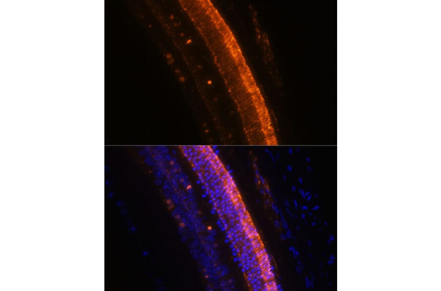 Immunofluorescence - Anti-KCNS2 Antibody (A90405) - Antibodies.com