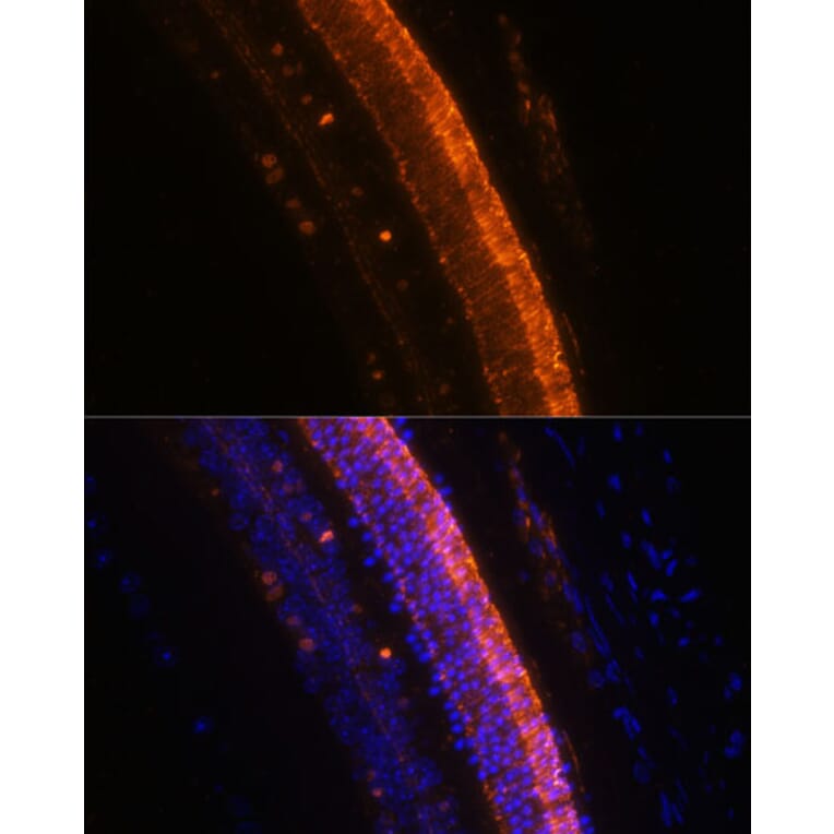 Immunofluorescence - Anti-KCNS2 Antibody (A90405) - Antibodies.com