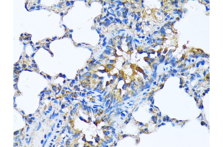 Immunohistochemistry - Anti-Milk Fat Globule 1 Antibody (A90406) - Antibodies.com
