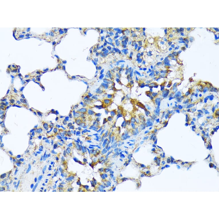 Immunohistochemistry - Anti-Milk Fat Globule 1 Antibody (A90406) - Antibodies.com