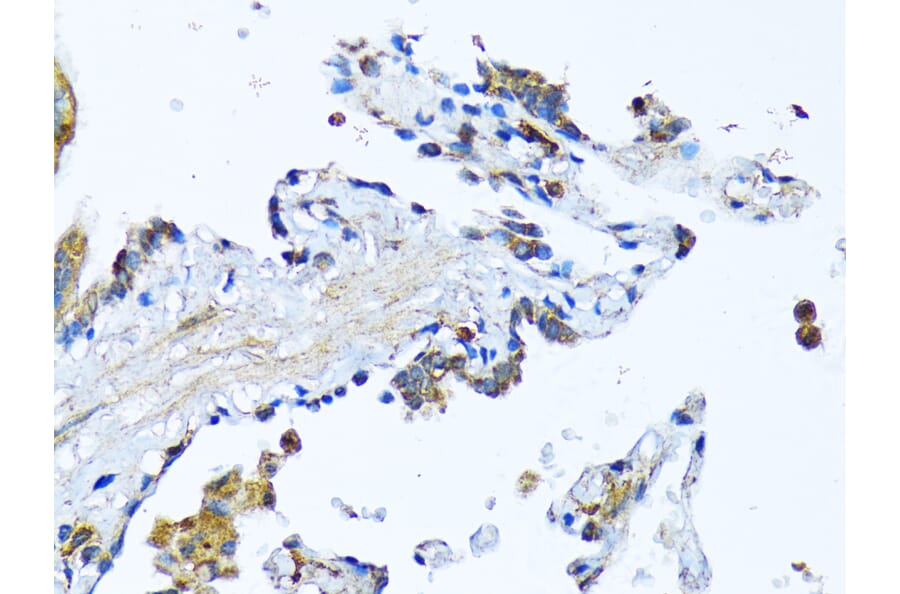 Immunohistochemistry - Anti-Milk Fat Globule 1 Antibody (A90406) - Antibodies.com