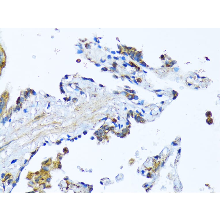 Immunohistochemistry - Anti-Milk Fat Globule 1 Antibody (A90406) - Antibodies.com