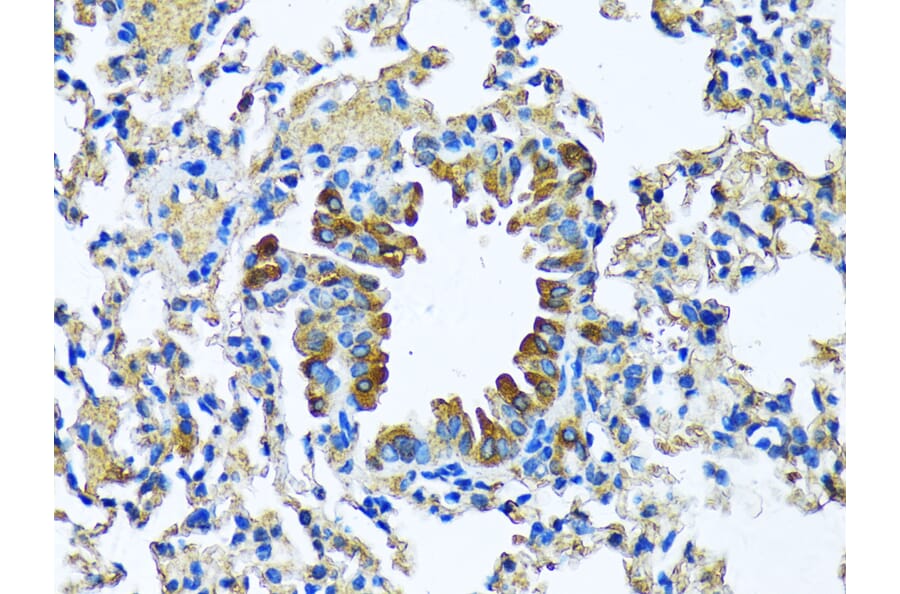 Immunohistochemistry - Anti-Milk Fat Globule 1 Antibody (A90406) - Antibodies.com
