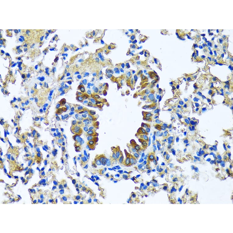 Immunohistochemistry - Anti-Milk Fat Globule 1 Antibody (A90406) - Antibodies.com