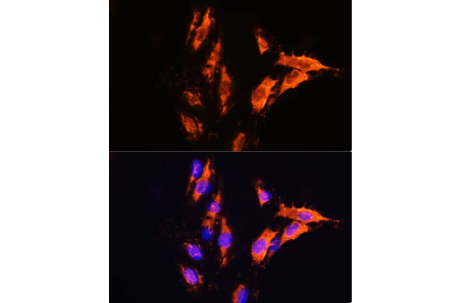 Immunofluorescence - Anti-Milk Fat Globule 1 Antibody (A90406) - Antibodies.com