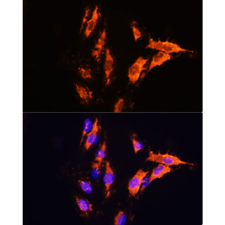 Immunofluorescence - Anti-Milk Fat Globule 1 Antibody (A90406) - Antibodies.com