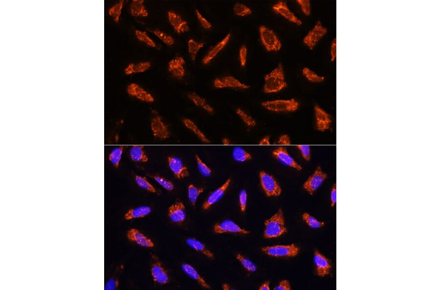 Immunofluorescence - Anti-Milk Fat Globule 1 Antibody (A90406) - Antibodies.com