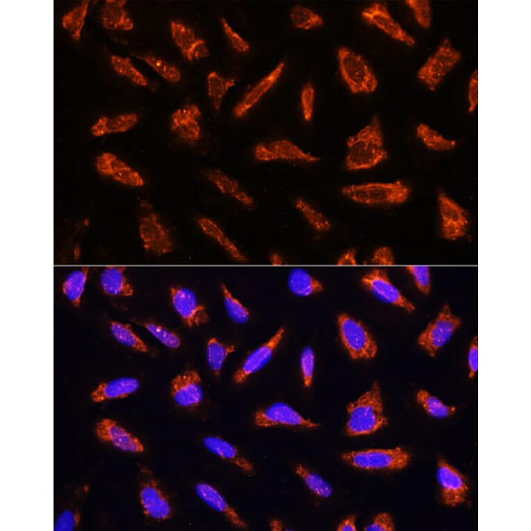 Immunofluorescence - Anti-Milk Fat Globule 1 Antibody (A90406) - Antibodies.com