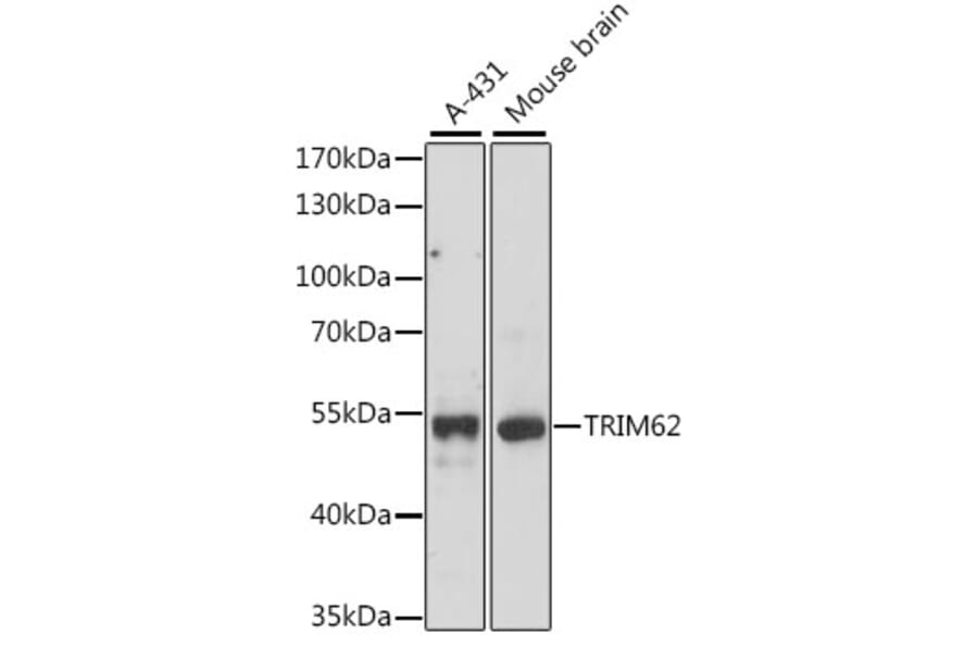 Western Blot - Anti-TRIM62 Antibody (A90407) - Antibodies.com
