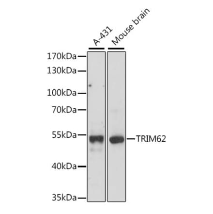 Western Blot - Anti-TRIM62 Antibody (A90407) - Antibodies.com
