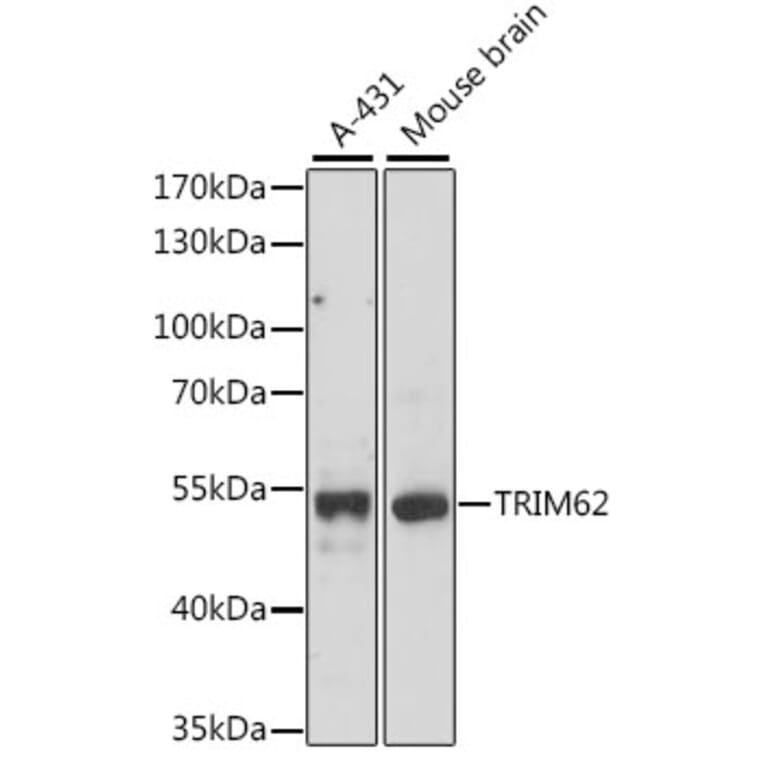 Western Blot - Anti-TRIM62 Antibody (A90407) - Antibodies.com