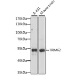 Western Blot - Anti-TRIM62 Antibody (A90407) - Antibodies.com