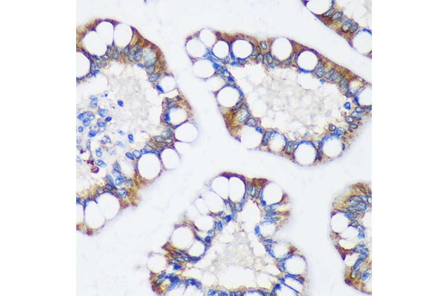 Immunohistochemistry - Anti-TRIM62 Antibody (A90407) - Antibodies.com