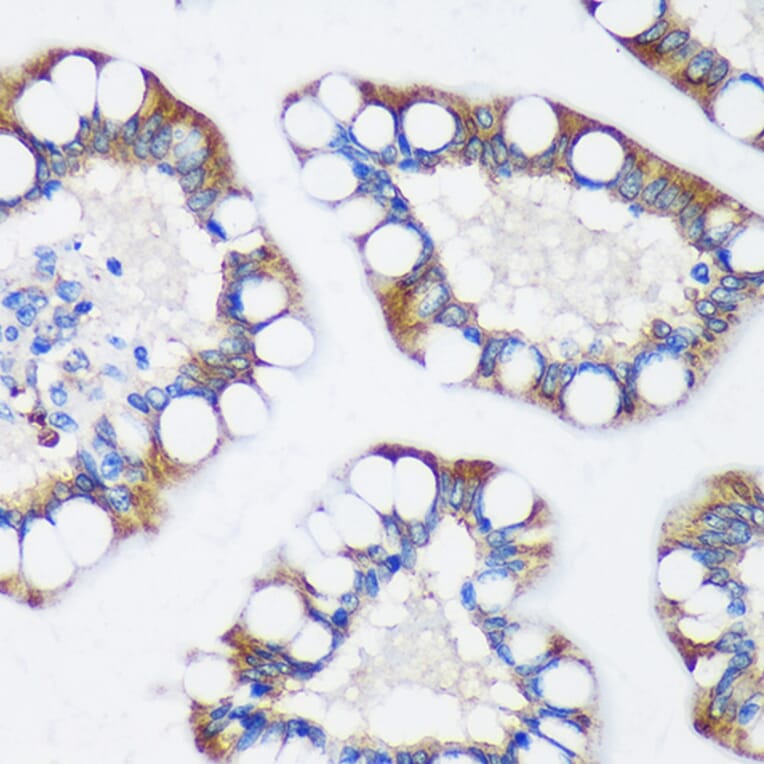 Immunohistochemistry - Anti-TRIM62 Antibody (A90407) - Antibodies.com