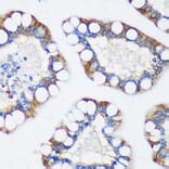 Immunohistochemistry - Anti-TRIM62 Antibody (A90407) - Antibodies.com
