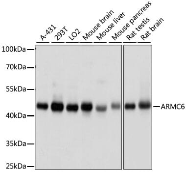 Western blot analysis of extracts of various cell lines, using Anti-ARMC6 Antibody (A15931) at 1000 dilution.
Secondary antibody: Goat Anti-Rabbit IgG (H+L) (HRP) (AS014) at 1:10,000 dilution.
Lysates / proteins: 25µg per lane.
Blocking buffer: 3% non-fat dry milk in TBST.
Detection: ECL Basic Kit (RM00020).
Exposure time: 10s.