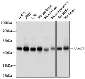 Western Blot - Anti-ARMC6 Antibody (A90408) - Antibodies.com