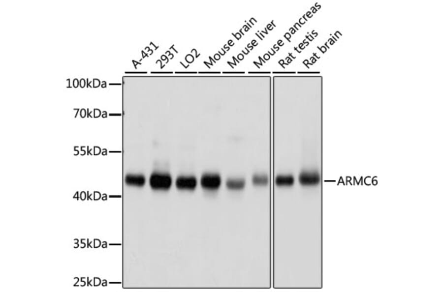Western Blot - Anti-ARMC6 Antibody (A90408) - Antibodies.com