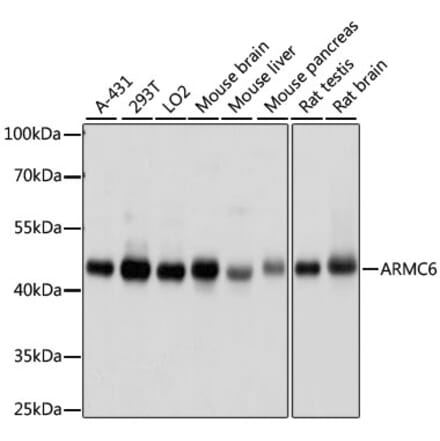 Western Blot - Anti-ARMC6 Antibody (A90408) - Antibodies.com