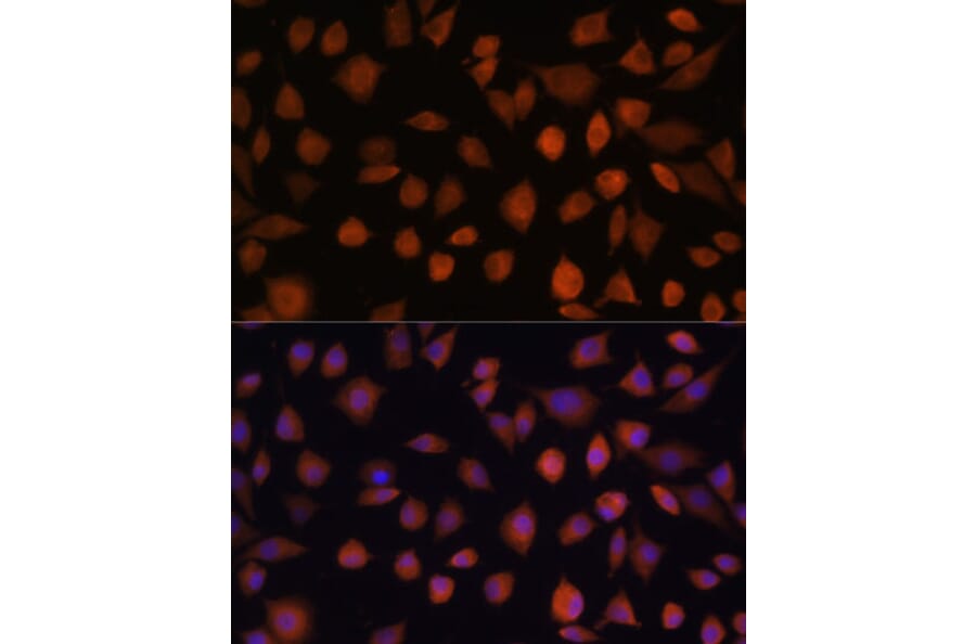 Immunofluorescence - Anti-ARMC6 Antibody (A90408) - Antibodies.com