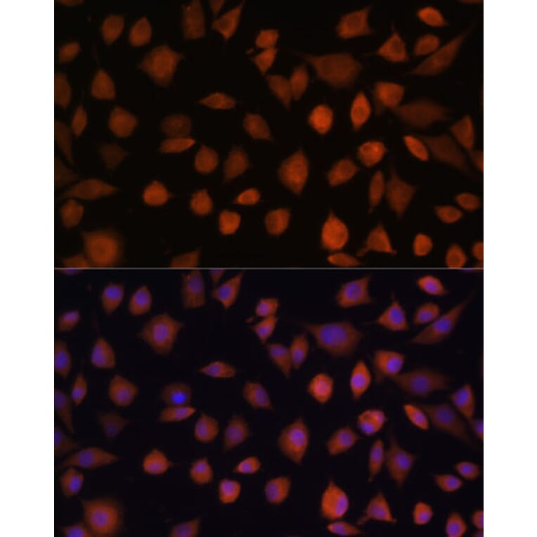 Immunofluorescence - Anti-ARMC6 Antibody (A90408) - Antibodies.com
