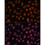 Immunofluorescence - Anti-ARMC6 Antibody (A90408) - Antibodies.com