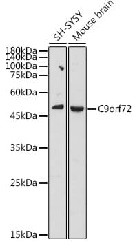 Western blot analysis of extracts of mouse kidney, using Anti-C9orf72 Antibody (A15970) at 1000 dilution.
Secondary antibody: Goat Anti-Rabbit IgG (H+L) (HRP) (AS014) at 1:10,000 dilution.
Lysates / proteins: 25µg per lane.
Blocking buffer: 3% non-fat dry milk in TBST.
Detection: ECL Basic Kit (RM00020).
Exposure time: 90s.