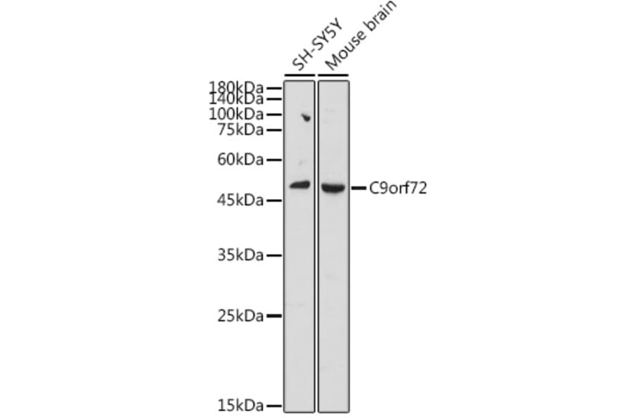 Western Blot - Anti-C9orf72 Antibody (A90409) - Antibodies.com