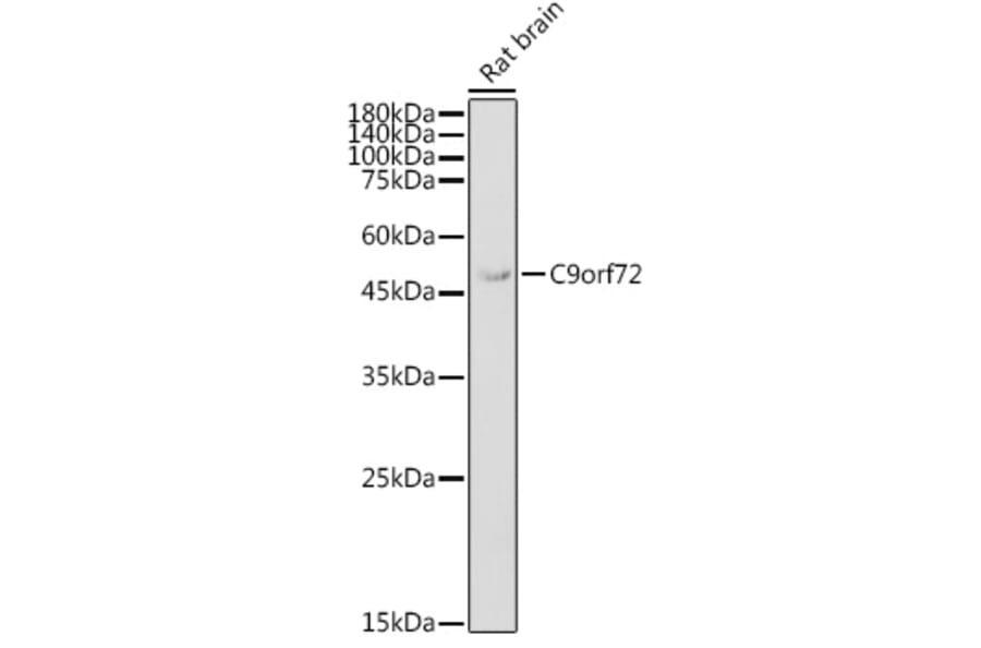 Western Blot - Anti-C9orf72 Antibody (A90409) - Antibodies.com