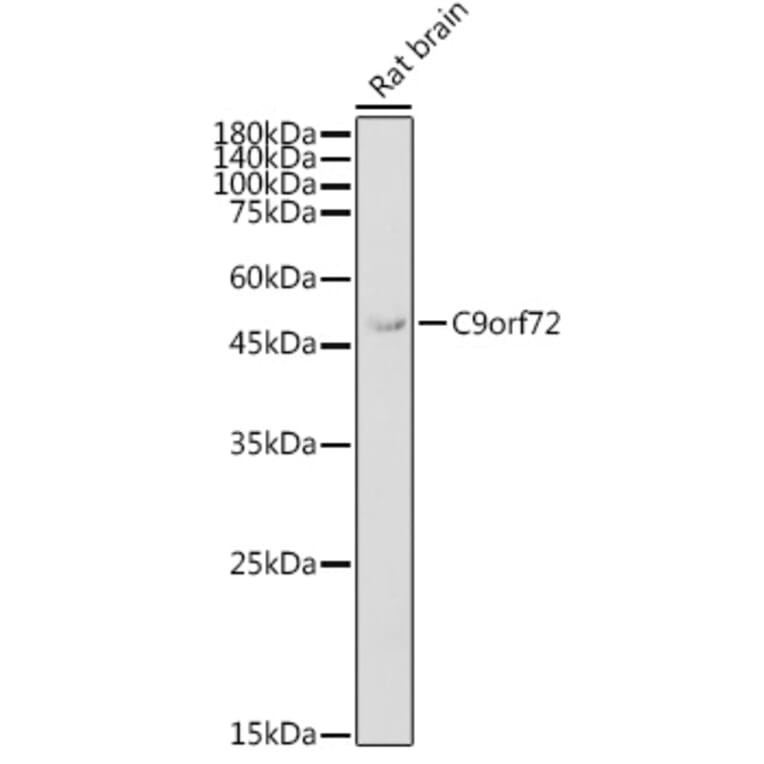 Western Blot - Anti-C9orf72 Antibody (A90409) - Antibodies.com