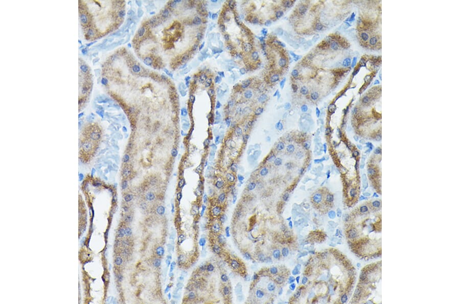 Immunohistochemistry - Anti-C9orf72 Antibody (A90409) - Antibodies.com