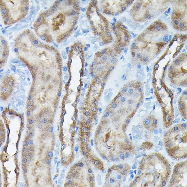 Immunohistochemistry - Anti-C9orf72 Antibody (A90409) - Antibodies.com