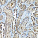 Immunohistochemistry - Anti-C9orf72 Antibody (A90409) - Antibodies.com