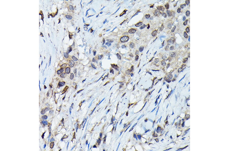 Immunohistochemistry - Anti-C9orf72 Antibody (A90409) - Antibodies.com