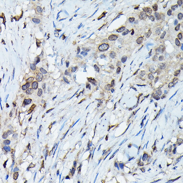 Immunohistochemistry - Anti-C9orf72 Antibody (A90409) - Antibodies.com