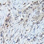 Immunohistochemistry - Anti-C9orf72 Antibody (A90409) - Antibodies.com