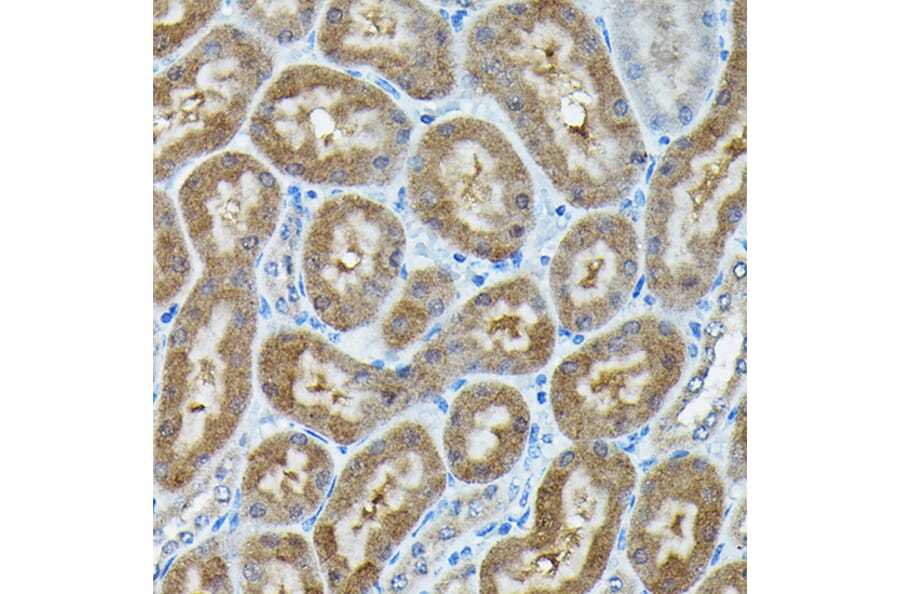 Immunohistochemistry - Anti-C9orf72 Antibody (A90409) - Antibodies.com