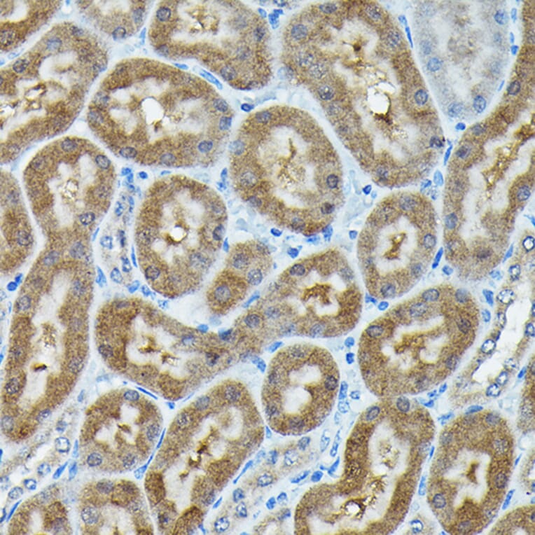 Immunohistochemistry - Anti-C9orf72 Antibody (A90409) - Antibodies.com