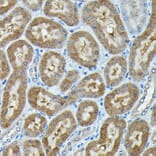 Immunohistochemistry - Anti-C9orf72 Antibody (A90409) - Antibodies.com