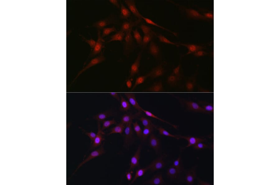 Immunofluorescence - Anti-C9orf72 Antibody (A90409) - Antibodies.com
