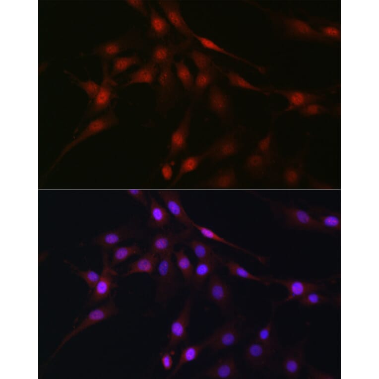 Immunofluorescence - Anti-C9orf72 Antibody (A90409) - Antibodies.com