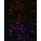 Immunofluorescence - Anti-C9orf72 Antibody (A90409) - Antibodies.com